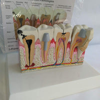  Modelo Anatomico Dental- Patología.