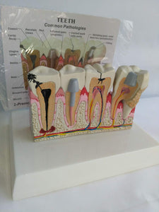  Modelo Anatomico Dental- Patología.