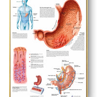 Póster de patologías humanas 