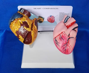 Modelo anatomico comparativo corazon de fumador