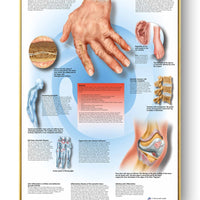 Póster Anatomía y enfermedades humanas 