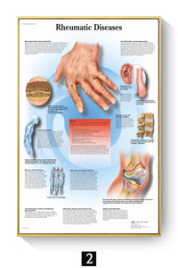 Póster Anatomía y enfermedades humanas 