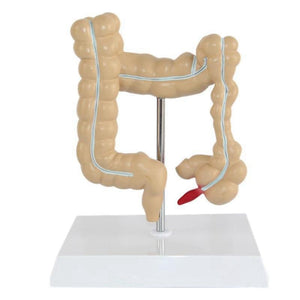 Modelo Anatomico intestino grueso (Patologias)