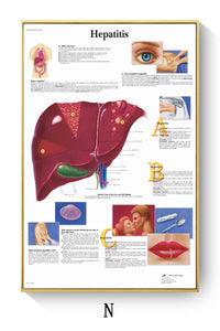 Póster de patologías humanas 