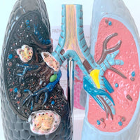 Modelo anatomico comparativo pulmon de fumador
