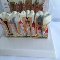  Modelo Anatomico Dental- Patología.
