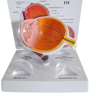 Modelo Optico Cataratas anatomia (cornea)
