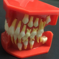 Modelo de reemplazo de dientes caducifolios para niños
