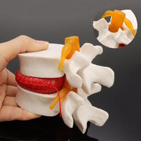 Modelo de vértebra lumbar
