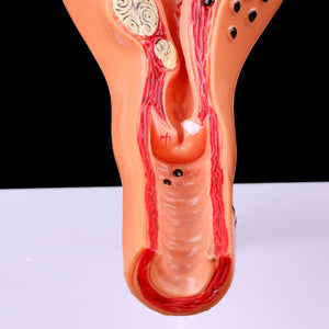 Modelo de patología uterina femenina humana (Patologias)