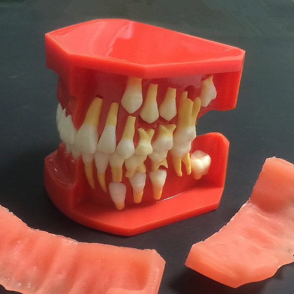 Modelo de reemplazo de dientes caducifolios para niños