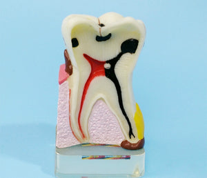 Modelo anatomíco- patología dientes humanos