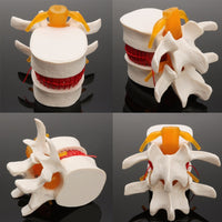 Modelo de vértebra lumbar
