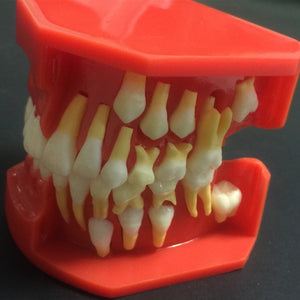 Modelo de reemplazo de dientes caducifolios para niños