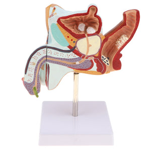 Modelo Anatomia Sistema Urinario Masculino (Patologias)