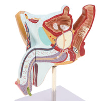 Modelo Anatomia Sistema Urinario Masculino (Patologias)
