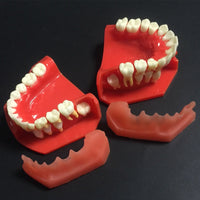 Modelo de reemplazo de dientes caducifolios para niños
