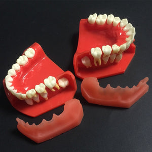 Modelo de reemplazo de dientes caducifolios para niños