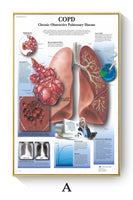 Póster de patologías humanas 
