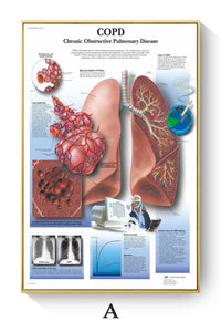 Póster de patologías humanas 