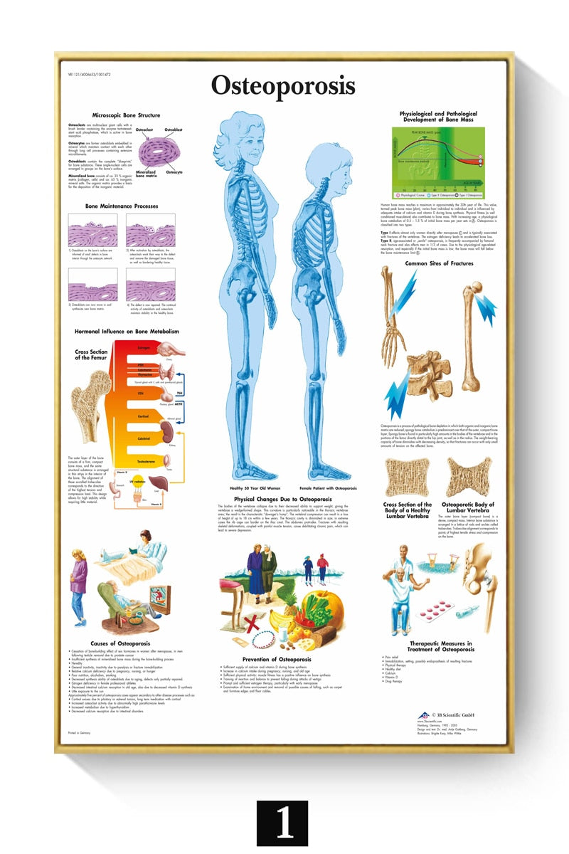 Póster Anatomía y enfermedades humanas 