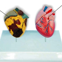 Modelo anatomico comparativo corazon de fumador