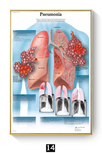 Póster Anatomía y enfermedades humanas 