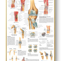 Póster Anatomía y enfermedades humanas 