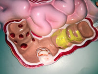 Modelo anatómico colorectal
