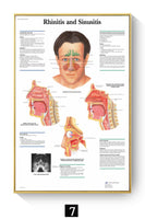 Póster Anatomía y enfermedades humanas 
