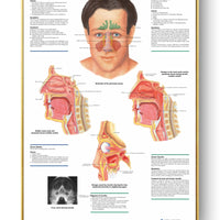 Póster Anatomía y enfermedades humanas 