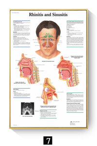 Póster Anatomía y enfermedades humanas 