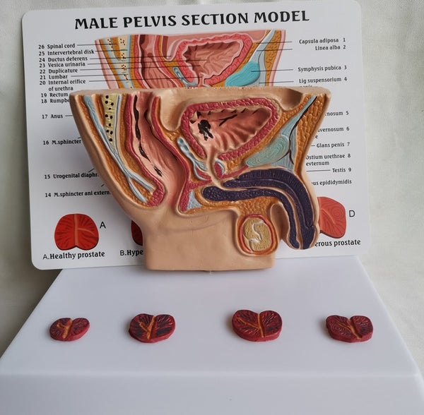 Pelvis masculina con vejiga y prostata