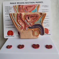 Pelvis masculina con vejiga y prostata