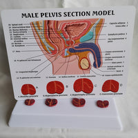 Pelvis masculina con vejiga y prostata