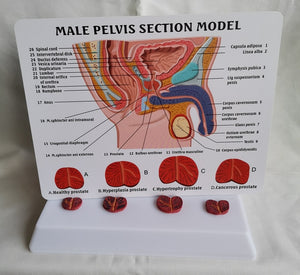 Pelvis masculina con vejiga y prostata