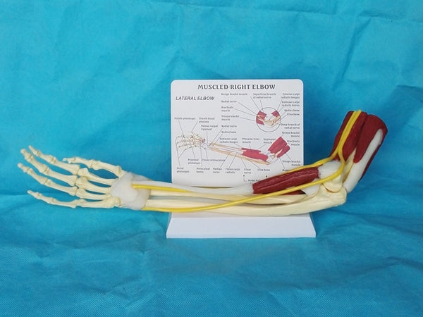 Modelo de función de ligamento articular