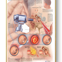 Póster Anatomía y enfermedades humanas 