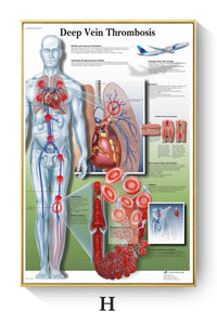 Póster de patologías humanas 