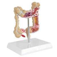 Modelo Anatomico de colon
