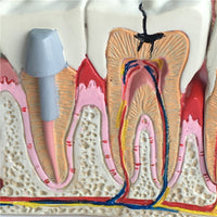  Modelo Anatomico Dental- Patología.
