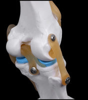 modelo anatómico de articulación de rodilla de tamaño real
