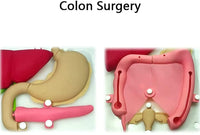 Modelo laparoscopia endoscopia de Silicon
