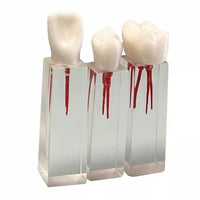 Modelo dental de restauracion  bloqueo endodoncia 6 piezas
