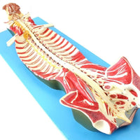 Modelo anatomico de espina dorsal humana anestesia columna vertebral nervio espinal