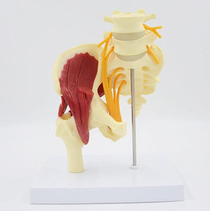 Articulación de Cadera con Modelo de nervio ciático