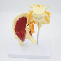 Articulación de Cadera con Modelo de nervio ciático
