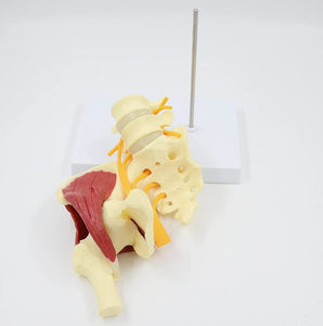 Articulación de Cadera con Modelo de nervio ciático