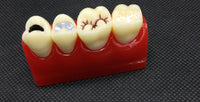 Modelo de empaste dental
