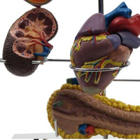 Modelo anatomia complicaciones diabetes 